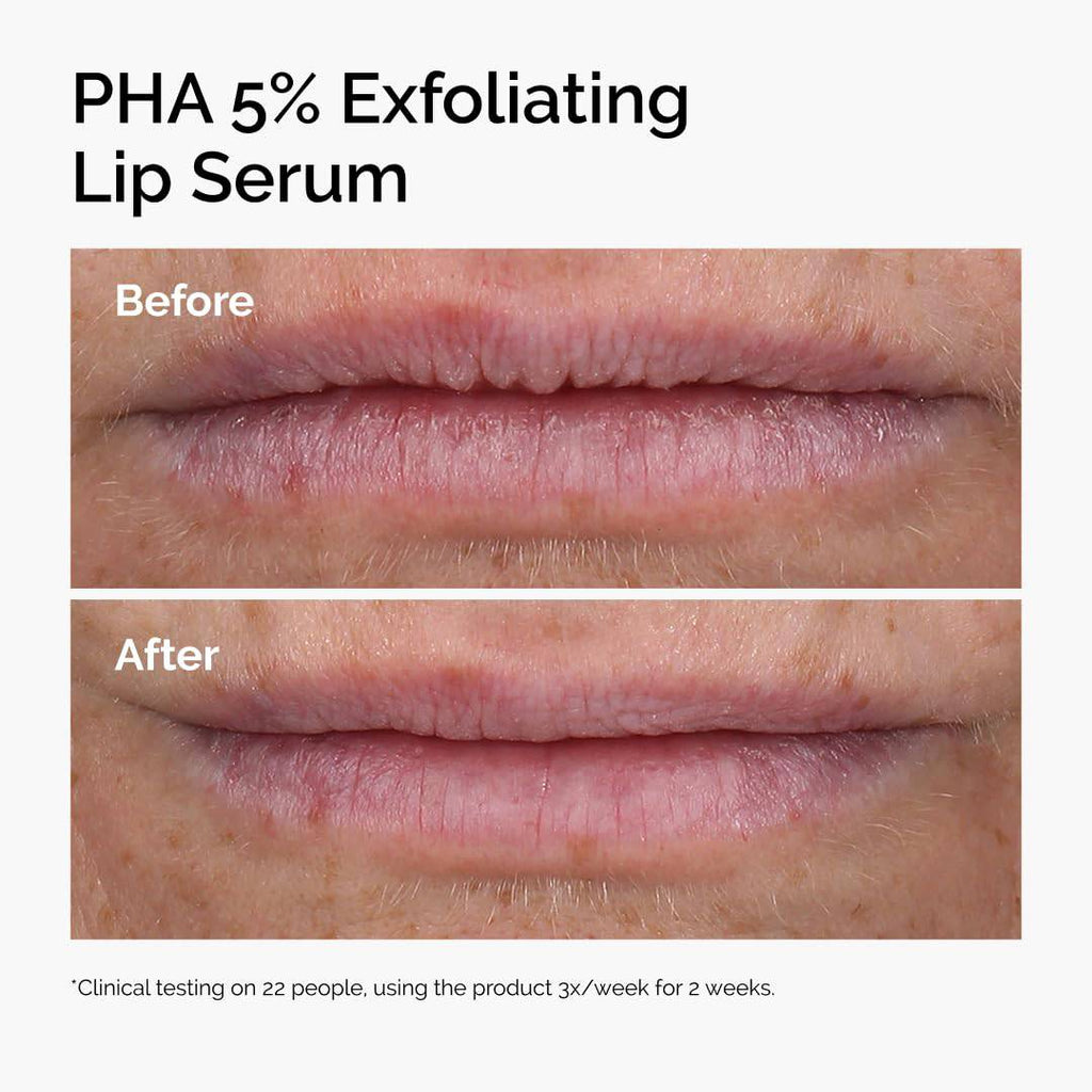 The Ordinary PHA 5% exfoliating lip serum in a small bottle, hydrating overnight lip treatment with clear liquid inside.