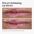 SlimBag The Ordinary Lip Care Duo with PHA exfoliating lip serum and nourishing squalane and amino acids lip balm.