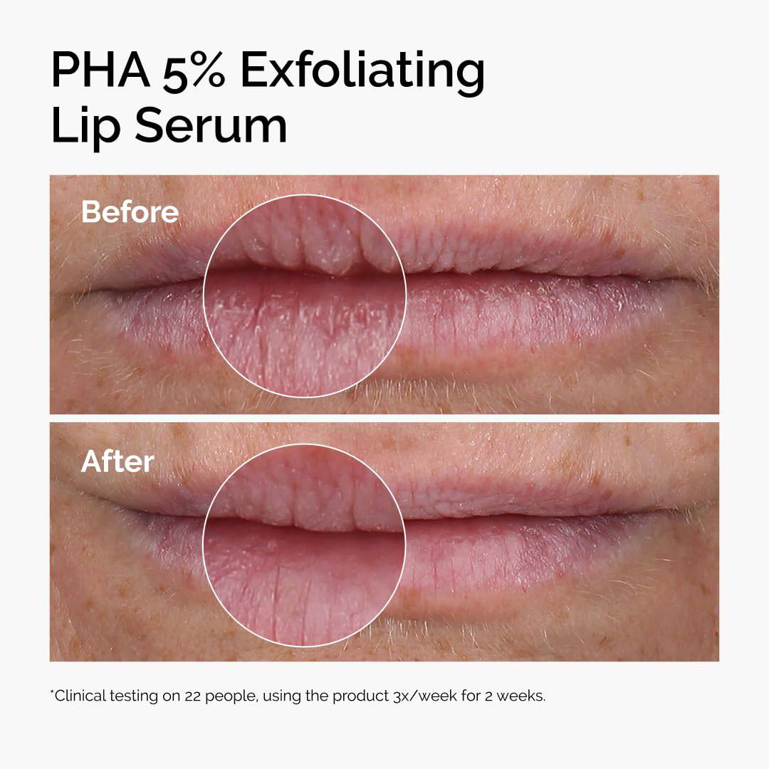SlimBag The Ordinary Lip Care Duo with PHA exfoliating lip serum and nourishing squalane and amino acids lip balm.