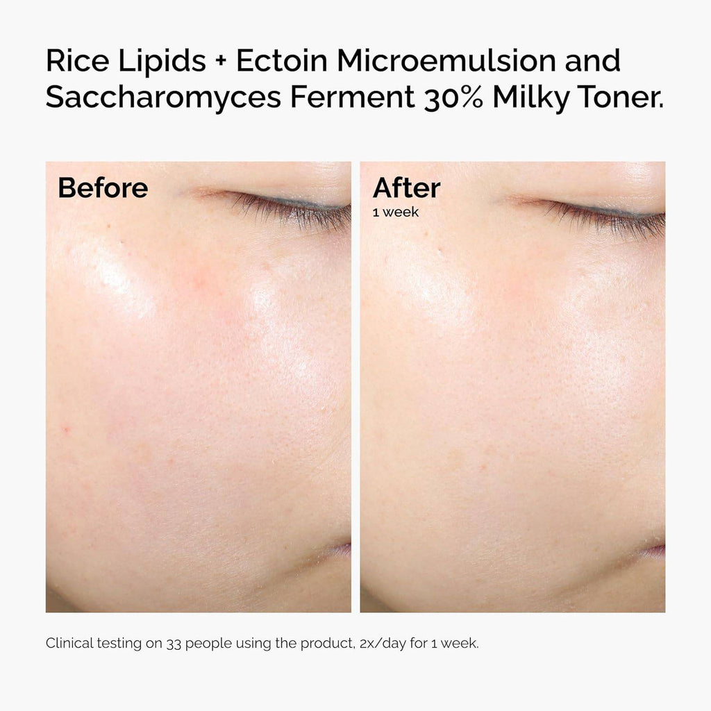SlimBag The Ordinary Rice Lipids and Ectoin microemulsion moisturizer for dry skin with soothing hydration and barrier repair.