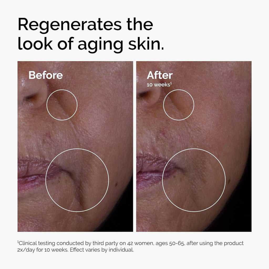 SlimBag The Ordinary GF 15% Solution anti-aging serum in a 1 fl oz bottle, showing the product label and packaging.