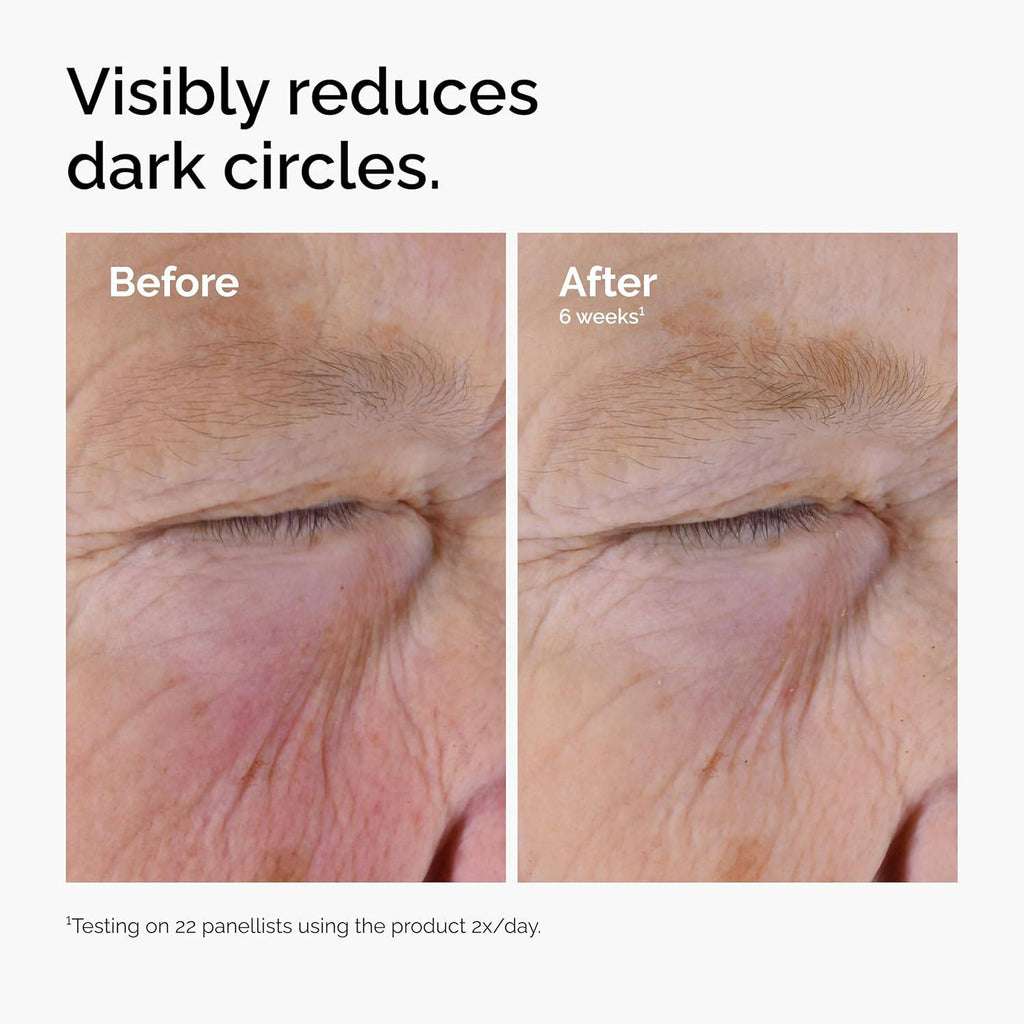 SlimBag depuffing eye serum with caffeine and EGCG, targeted for dark circles and tired eyes in a clear glass bottle