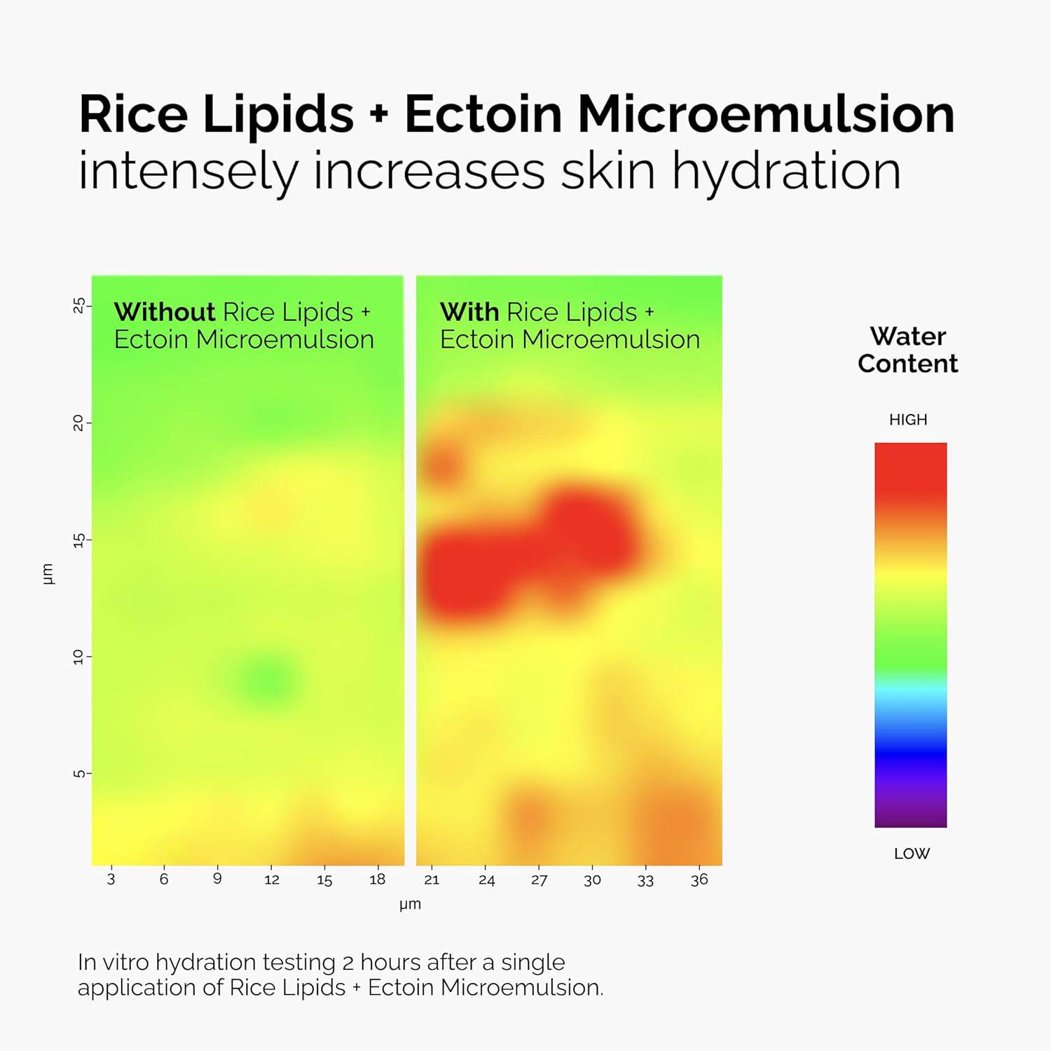 SlimBag Rice Lipids + Ectoin moisturizer for dry skin, soothing hydration, barrier repair, and redness reduction in a microemulsion format.