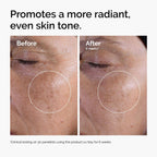 SlimBag The Ordinary mini icon set with travel-size skincare including glycolic acid toner, niacinamide serum, hyaluronic acid, and reusable rounds.