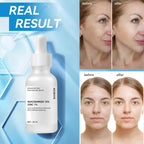 SlimBag Niacinamide 10% + Zinc 1% facial serum bottle showing clear liquid, lightweight, non-greasy formula for acne and pore control.