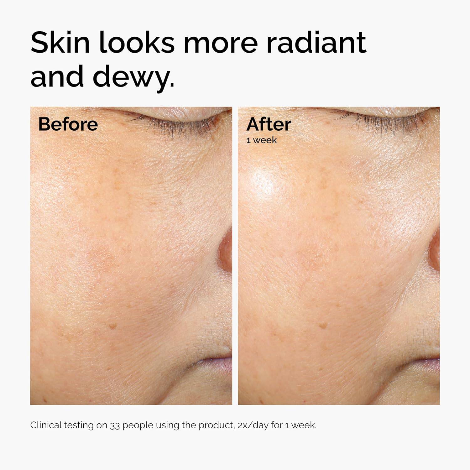 SlimBag The Ordinary Rice Lipids and Ectoin Microemulsion moisturizer for dry skin, soothing hydration and barrier repair.