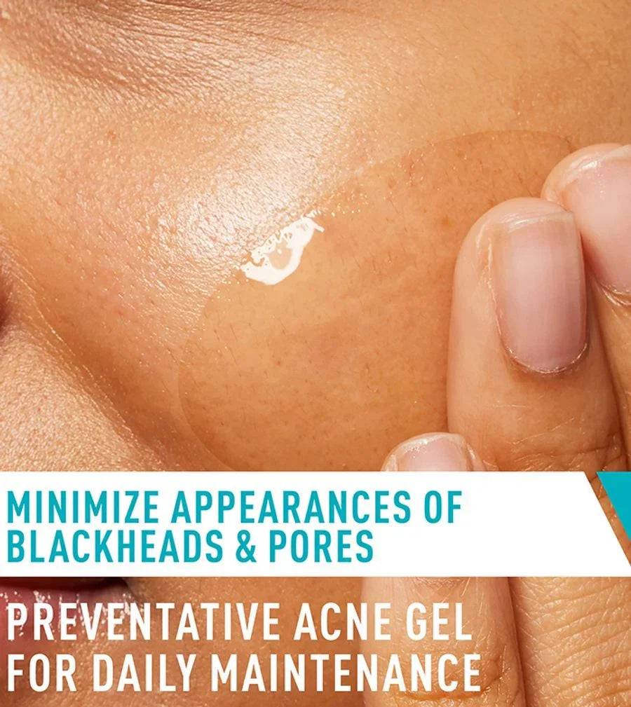 SlimBag CeraVe Acne Control Gel being applied to skin, featuring clear gel texture for acne treatment and skincare.