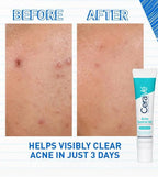 SlimBag CeraVe Acne Control Gel in a tube, showing the skincare product designed to help treat and prevent acne breakouts.