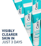 SlimBag CeraVe Acne Control Gel showing clear skin and product packaging on a desktop for effective acne treatment.