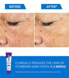 Side-by-side images showing skin before and after using SlimBag Skin Renewing Brightening Lotion with SPF 30 for even skin tone.
